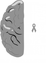 Life Can Change In An Instant - Brain Cancer DTF Transfers
